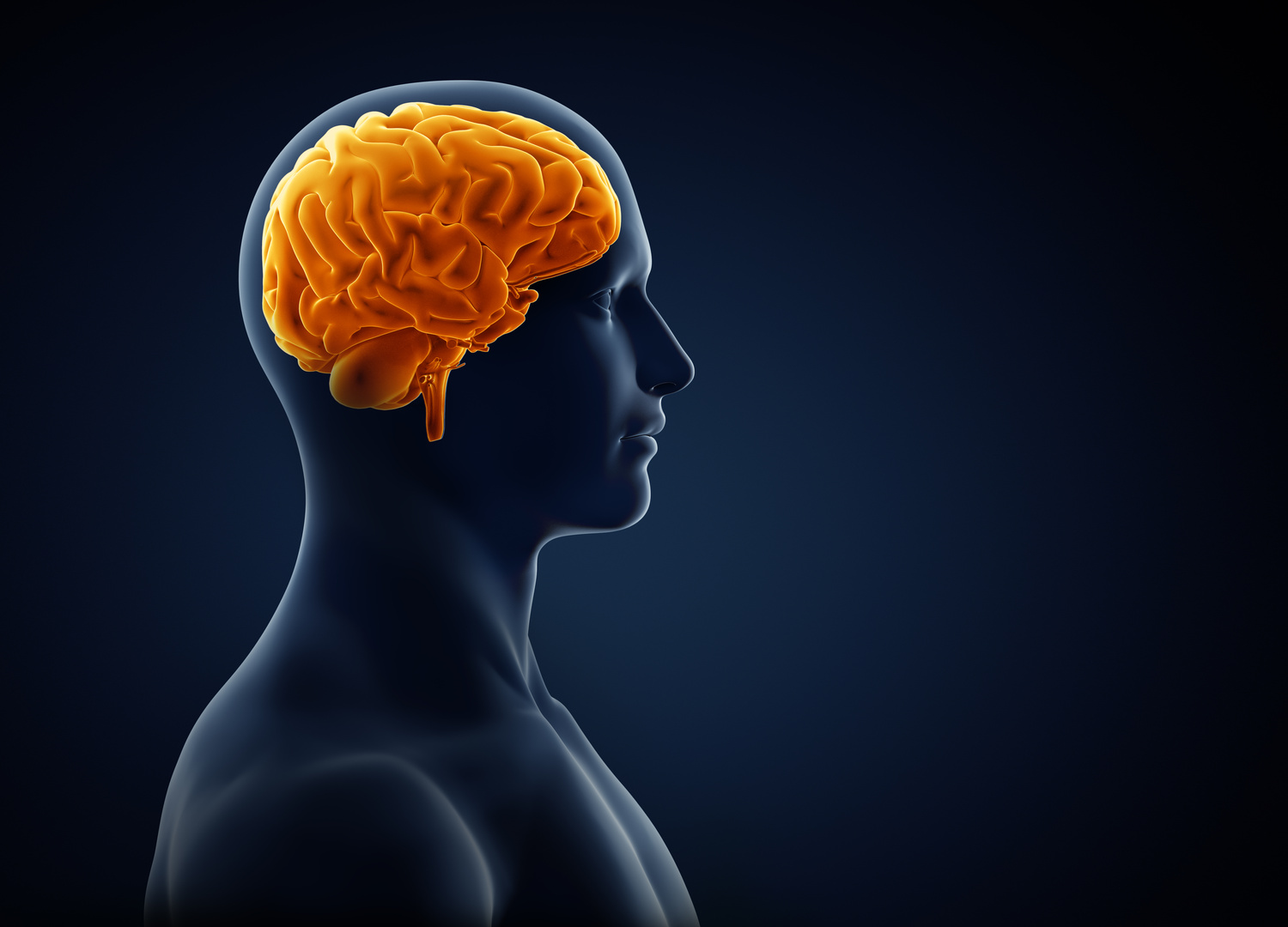 brain xray